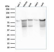 Western blot testing of human samples with MCM7 antibody (clone MCM7/2756R). Expected molecular weight: 80-90 kDa.