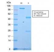 SDS-PAGE analysis of purified, BSA-free recombinant Cytokeratin 18 antibody (clone KRT18/2819R) as confirmation of integrity and purity.