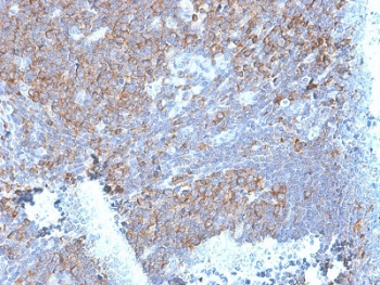 IHC testing of FFPE human tonsil stained with RPSA antibody. Required HIER: boiling tissue sections in pH 9 10mM Tris with 1mM EDTA for 10-20 min followed by cooling at RT for 20 min.