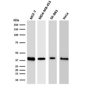 Western blot testing of human MCF-7, MDA-MB-453, SK-BR3, and HeLa cell lysate with RPSA antibody. Routinely observed molecular weight: 37-40 kDa and 67 kDa.
