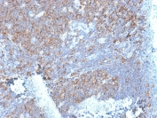 IHC testing of FFPE human tonsil stained with RPSA antibody (clone RPSA/2699). Required HIER: boiling tissue sections in pH 9 10mM Tris with 1mM EDTA for 10-20 min followed by cooling at RT for 20 min.