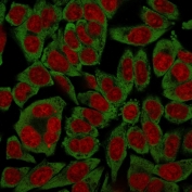 Immunofluorescent staining of human HeLa cells with RPSA antibody (green, clone RPSA/2699) and Reddot nuclear stain (red).