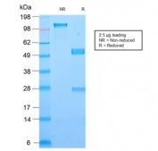 SDS-PAGE analysis of purified, BSA-free recombinant Galectin 1 antibody (clone GAL1/2499R) as confirmation of integrity and purity.