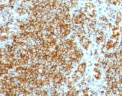 IHC staining of FFPE human lymph node with recombinant HCAM antibody (clone HCM15-2R). HIER: boil tissue sections in pH6, 10mM citrate buffer, for 10-20 min followed by cooling at RT for 20 min.