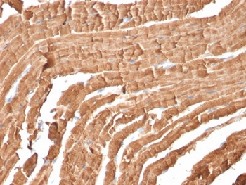 IHC staining of FFPE mouse heart with Myoglobin antibody (MB/2105). HIER: boil tissue sections in pH6, 10mM citrate buffer, for 10-20 min and allow to cool before testing.~