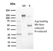 SDS-PAGE analysis of purified, BSA-free MDM2 antibody (clone MDM2/2414) as confirmation of integrity and purity.