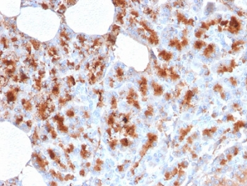 IHC testing of FFPE human pancreas stained with MDM2 antibody. Required HIER: boiling tissue sections in 10mM citrate buffer, pH6, for 10-20 min followed by cooling at RT for 20 min.~