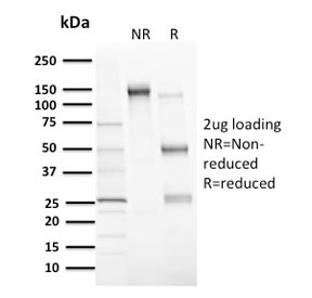 SDS-PAGE analysis of purified, BSA-free MDM2 antibody