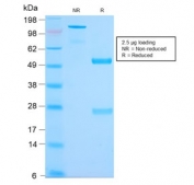 SDS-PAGE analysis of purified, BSA-free recombinant MUC2 antibody (clone MLP/2970R) as confirmation of integrity and purity.