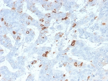 IHC staining of FFPE human colon tissue with recombinant MUC2 antibody (clone MLP/2970R). HIER: boil tissue sections in 10mM Tris-HCl buffer, pH 10, for 10-20 min and allow to cool before testing.~