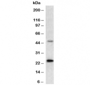 Western blot testing of human MCF-7 cell lysate with recombinant Mammaglobin A antibody (clone MMGA-1R). Expected molecular weight: 10-21 kDa depending on level of glycosylation.