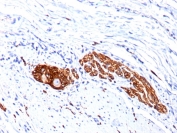 IHC staining of FFPE human colon ganglion tissue with CD56 antibody (clone 123C3.D5 + 123A8). HIER: boil tissue sections in pH9 EDTA buffer for 10-20 min followed by cooling at RT for 20 min.