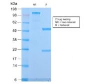 SDS-PAGE analysis of purified, BSA-free recombinant Mucin-1 antibody (clone MUC1/2818R) as confirmation of integrity and purity.
