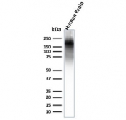 Western blot testing of human brain lysate with recombinant Neurofilament antibody. Expected molecular weight ~200 kDa.