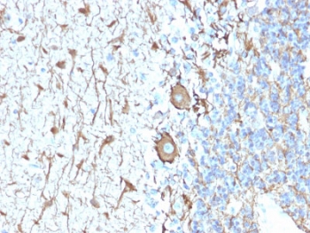 IHC staining of FFPE human cerebellum with recombinant Neurofilament antibody (clone NEFL.H/2324R). Required HIER: boil tissue sections in 10mM citrate buffer, pH6, for 10-20 min and allow to cool before testing.~