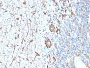 IHC staining of FFPE human cerebellum with recombinant Neurofilament antibody (clone NEFL.H/2324R). Required HIER: boil tissue sections in 10mM citrate buffer, pH6, for 10-20 min and allow to cool before testing.