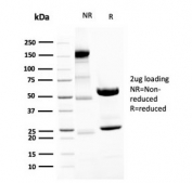 SDS-PAGE analysis of purified, BSA-free recombinant Neurofilament antibody (clone NEFL.H/2324R) as confirmation of integrity and purity.