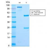 SDS-PAGE analysis of purified, BSA-free recombinant Neurofilament antibody (clone NEFL/2983R) as confirmation of integrity and purity.