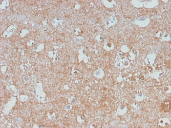 IHC staining of human cerebellum with recombinant Neurofilament antibody (clone NEFL/2983R). HIER: boil tissue sections in pH 9 10mM Tris with 1mM EDTA for 10-20 min and allow to cool before testing.~