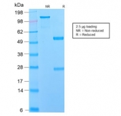 SDS-PAGE analysis of purified, BSA-free recombinant NGFR antibody (clone NGFR/2550R) as confirmation of integrity and purity.