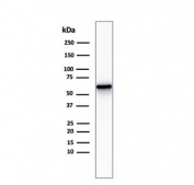 Western blot testing of human U-87 cell lysate with recombinant NGFR antibody (clone NGFR/2550R). Predicted molecular weight: 45-75 kDa depending on glycosylation level.
