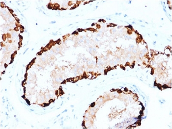 IHC testing of FFPE human testis stained with MAGEA4 antibody. Required HIER: boiling tissue sections in 10mM citrate buffer, pH6, for 10-20 min followed by cooling at RT for 20 min.