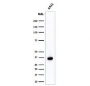 Western blot testing of human A431 cell lysate with Nucleophosmin antibody (clone NPM1/1902). Expected molecular weight ~38 kDa.