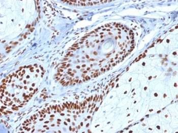 IHC staining of FFPE human skin with Nucleophosmin antibody. HIER: boil tissue sections in pH6, 10mM citrate buffer, for 10-20 min and allow to cool before testing.