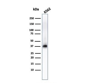 Western blot testing of human K562 cell lysate with Nucleophosmin antibody. Expected molecular weight ~38 kDa.