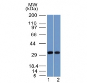 Western blot testing of human 1) MCF7 and 2) A431 cell lysate with Nucleophosmin antibody (clone NPM1/1902). Expected molecular weight ~38 kDa.