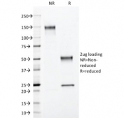 SDS-PAGE analysis of purified, BSA-free Progesterone Receptor antibody (clone PGR/2694) as confirmation of integrity and purity.
