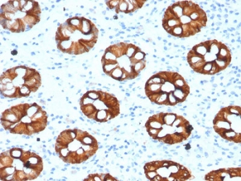 IHC testing of human colon with CK20 antibody (clone KRT20/1993). Required HIER: boil tissue sections in 10mM citrate buffer, pH 6, for 10-20 min followed by cooling at RT for 20 min.~