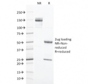 SDS-PAGE analysis of purified, BSA-free CK20 antibody (clone KRT20/1993) as confirmation of integrity and purity.