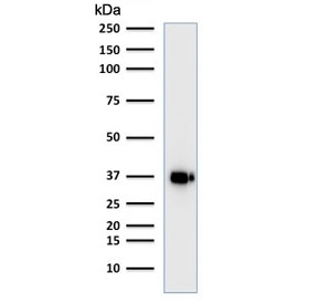 Western blot testing of human Raji cell lysate with BOB1 antibody (clone BOB1/2421). Predicted molecular weight: ~28 kDa (unmodified), 35-40 kDa (ubiquitinated).~