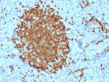 IHC testing of FFPE human spleen with BOB1 antibody (clone BOB1/2421). HIER: boil tissue sections in pH6, 10mM citrate buffer, for 10-20 min followed by cooling at RT for 20 min.