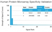 Analysis of HuProt(TM) microarray containing more than 19,000 full-length human proteins using RAD51 antibody (clone RAD51/2753). These results demonstrate the foremost specificity of the RAD51/2753 mAb. Z- and S- score: The Z-score represents the strength of a signal that an antibody (in combination with a fluorescently-tagged anti-IgG secondary Ab) produces when binding to a particular protein on the HuProt(TM) array. Z-scores are described in units of standard deviations (SD's) above the mean value of all signals generated on that array. If the targets on the HuProt(TM) are arranged in descending order of the Z-score, the S-score is the difference (also in units of SD's) between the Z-scores. The S-score therefore represents the relative target specificity of an Ab to its intended target.