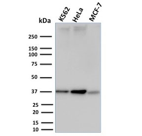 Western blot testing of human K562, HeLa and MCF-7 cell lysate with RAD51 antibody. Expected molecular weight ~37 kDa.~