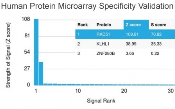 Analysis of HuProt(TM) microarray containing more than 19,000 full-length human proteins using RAD51 antibody. These