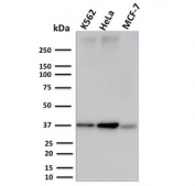 Western blot testing of human K562, HeLa and MCF-7 cell lysate with RAD51 antibody (clone RAD51/2753). Expected molecular weight ~37 kDa.