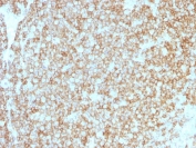 IHC testing of recombinant CD45 antibody cocktail and FFPE human tonsil (clones PTPRC/1975R + PTPRC/1783R). Required HIER: boil tissue sections in 10mM citrate buffer, pH 6, for 10-20 min followed by cooling at RT for 20 min.