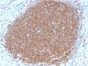 IHC staining of FFPE human lymph node with recombinant CD45RB antibody. HIER: boil tissue sections in pH6, 10mM citrate buffer, for 10-20 min followed by cooling at RT for 20 min.