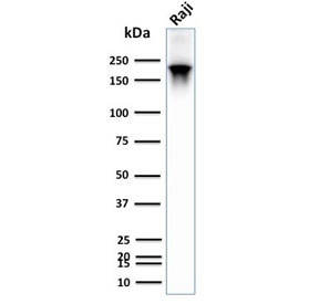 Western blot testing of recombinant CD45RB antibody and human Raji lysate. Expected molecular weight: 147-220 kDa depending on glycosylation level.~