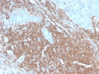 IHC staining of FFPE human lymph node with recombinant C