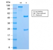 SDS-PAGE analysis of purified, BSA-free recombinant CD45RB antibody (clone PTPRC/2877R) as confirmation of integrity and purity.