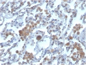 IHC staining of FFPE human lung with lung antibody. HIER: boil tissue sections in pH 9 10mM Tris with 1mM EDTA for 20 min and allow to cool before testing.