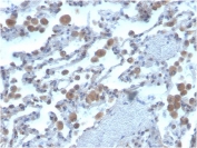 IHC staining of FFPE human lung with lung antibody. HIER: boil tissue sections in pH 9 10mM Tris with 1mM EDTA for 20 min and allow to cool before testing.