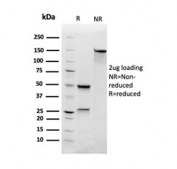 SDS-PAGE analysis of purified, BSA-free RAC1 antibody as confirmation of integrity and purity.