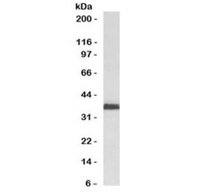 Western blot testing of human HeLa cell lysate with RAD51 antibody (clone RALPA-1). Expected molecular weight ~37 kDa.~