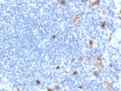IHC staining of FFPE human tonsil tissue with recombinant IgM antibody (clone MuHC2-2R). HIER: boil tissue sections in pH 9 10mM Tris with 1mM EDTA for 10-20 min and allow to cool before testing.