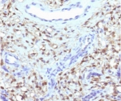 IHC testing of FFPE human placenta with recombinant S100A4 antibody (clone PS1A4-1R). Required HIER: steam sections in 10mM citrate buffer, pH 6, for 10-20 min and allow to cool before testing.